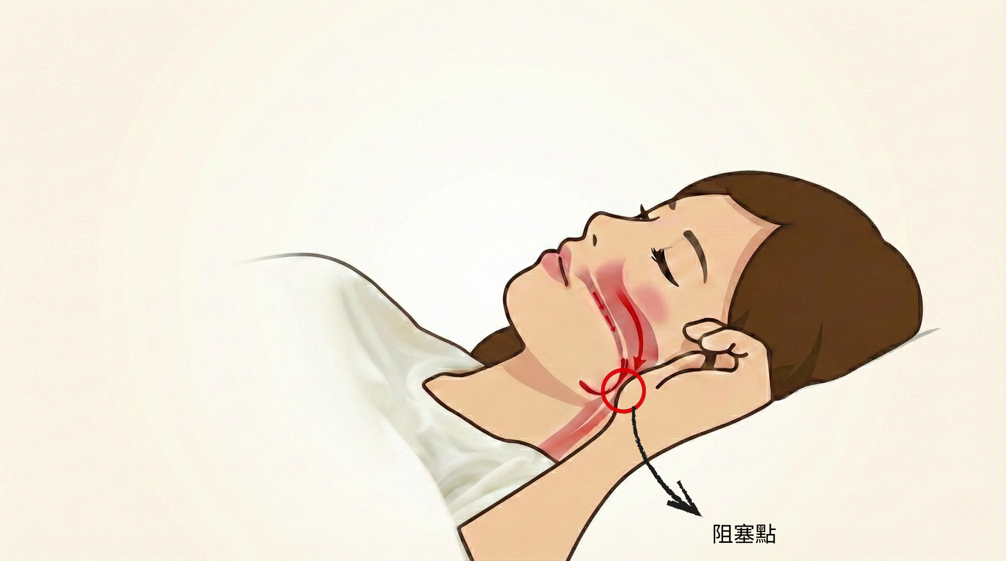 睡眠呼吸中止症新選擇：牙科治療邁向精準化！邱耀賢醫師獲頒OSAWELL「年度卓越獎」