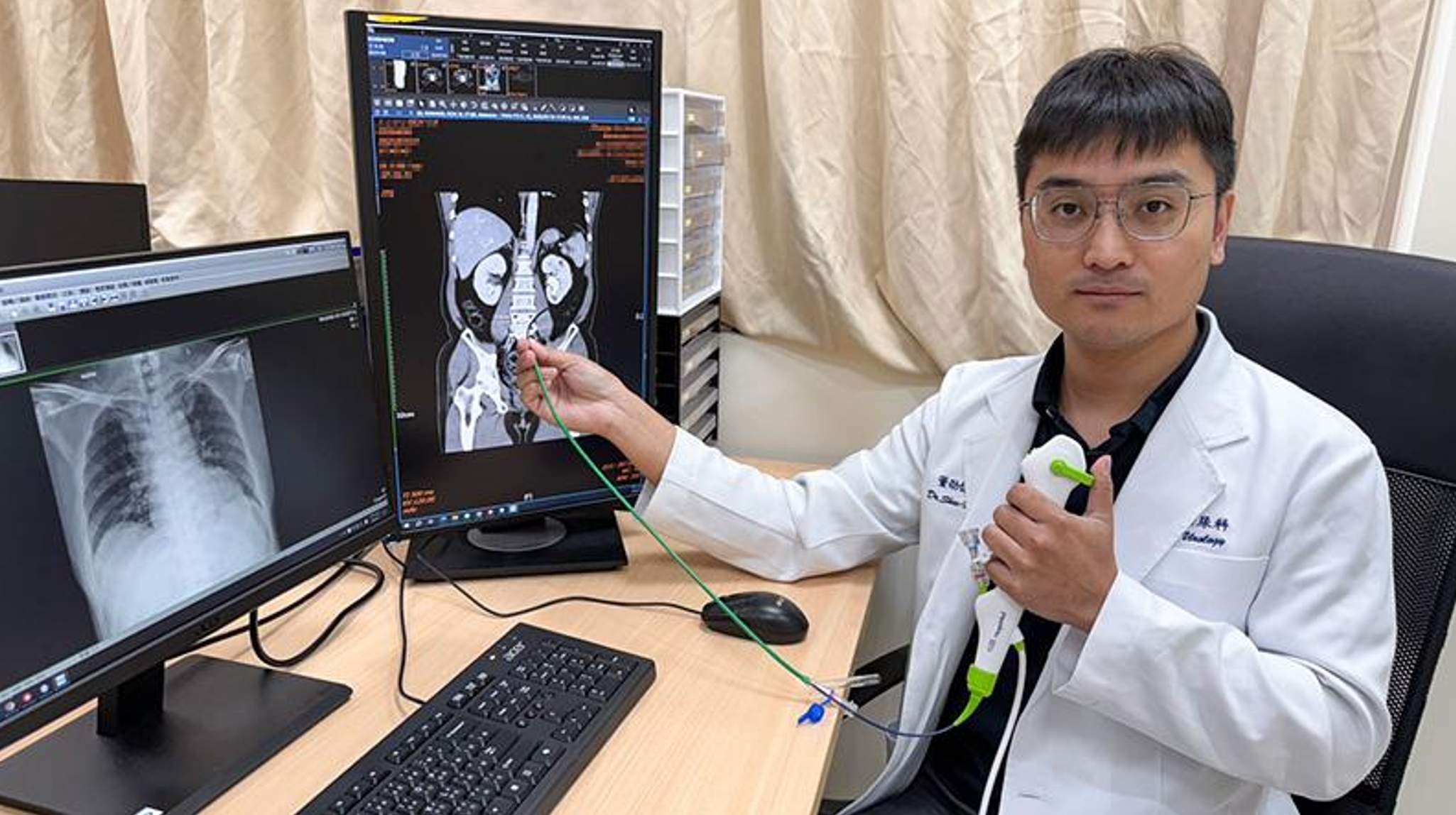 3公分鹿角腎結石引發血尿腰痛 極細軟鏡微創手術助患者擺脫困擾